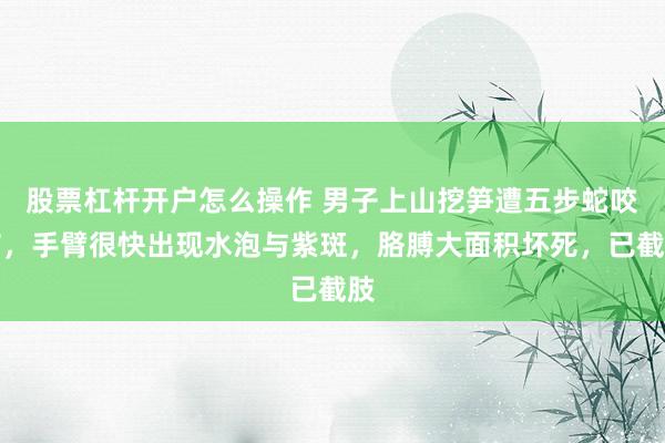 股票杠杆开户怎么操作 男子上山挖笋遭五步蛇咬伤，手臂很快出现水泡与紫斑，胳膊大面积坏死，已截肢